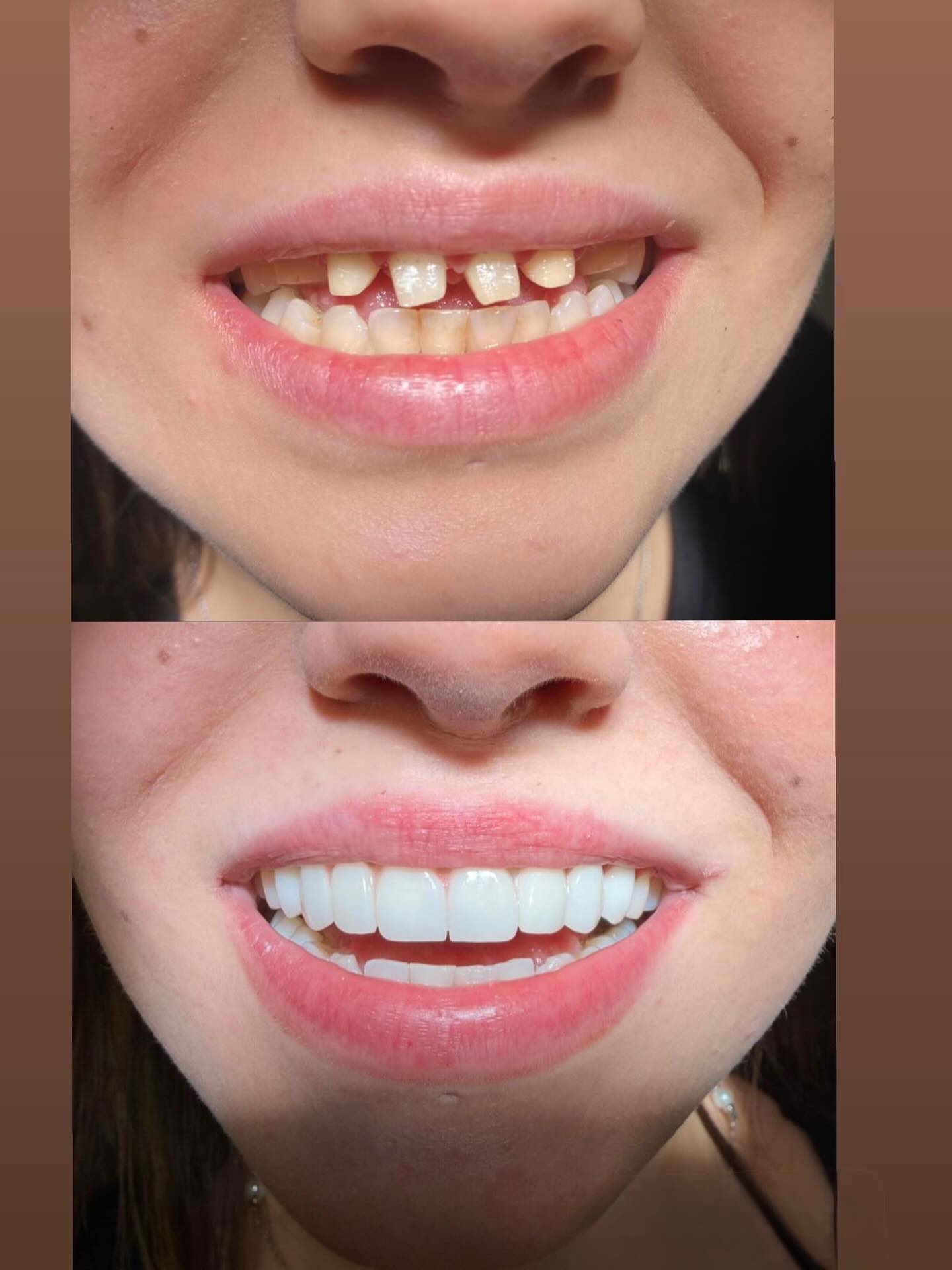 Tedavi Sonucu 19
